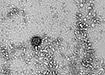 Снимок коронавируса, полученный методом негативного контрастирования в новосибирской лаборатории &quot;Вектор&quot;.  (2020) | Фото: Роспотребнадзор/ФБУН ГНЦ ВБ Вектор