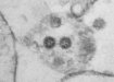 Фото омикрон-штамма коронавируса (2021) | Фото: ГНЦ ВБ &quot;Вектор&quot; / Роспотребнадзор