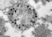 Фото омикрон-штамма коронавируса. (2021) | Фото: ГНЦ ВБ &quot;Вектор&quot; / Роспотребнадзор