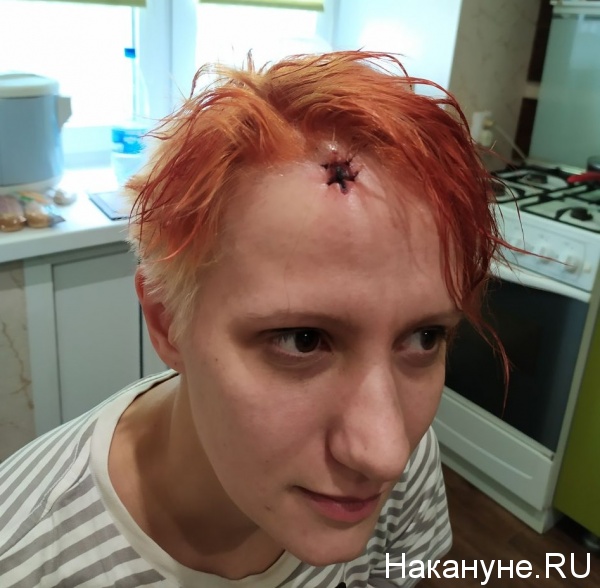 журналистка Юлия Зябрина, нападение, Челябинск,(2019)|Фото: Накануне.RU