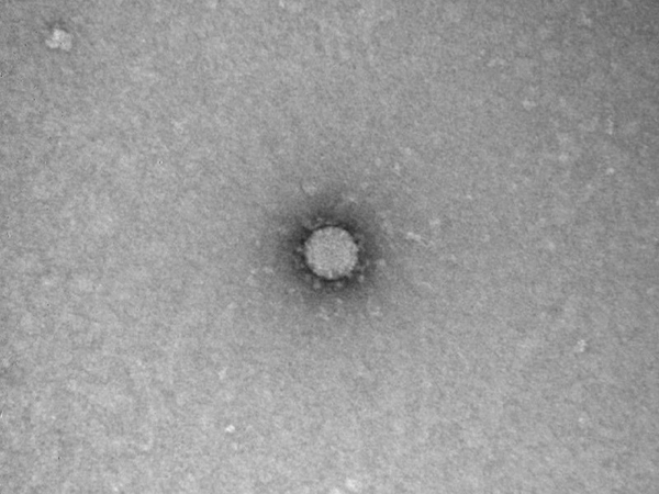 Снимок коронавируса, полученный методом негативного контрастирования в новосибирской лаборатории "Вектор". (2020) | Фото: Роспотребнадзор/ФБУН ГНЦ ВБ Вектор