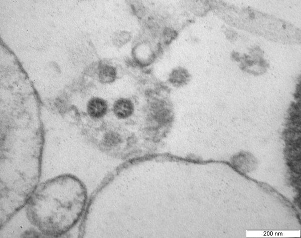 Фото омикрон-штамма коронавируса(2021)|Фото: ГНЦ ВБ "Вектор" / Роспотребнадзор