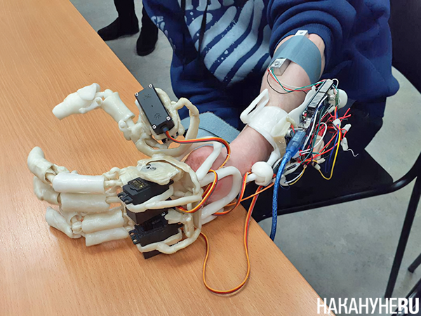 Уральский ученый изобрел новый бионический протез руки(2019)|Фото: Накануне.RU Уральский ученый изобрел новый бионический протез руки(2019)|Фото: Накануне.RU